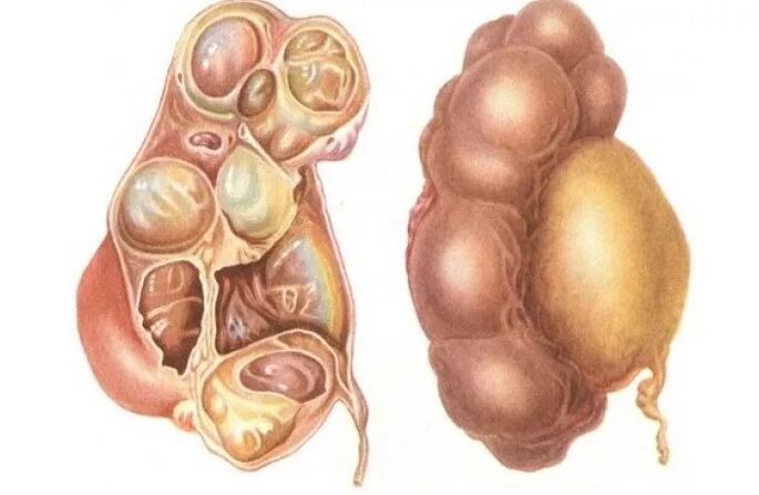 Vesicular