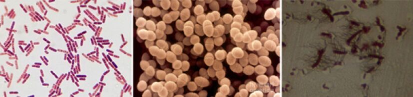 Escherichia sticks, fecal enterococcus and pro - the main pathogens of chronic bacterial prostatitis