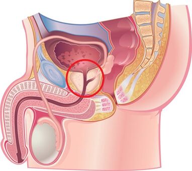 Prostate location to men