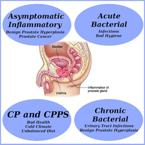 The causes of prostate